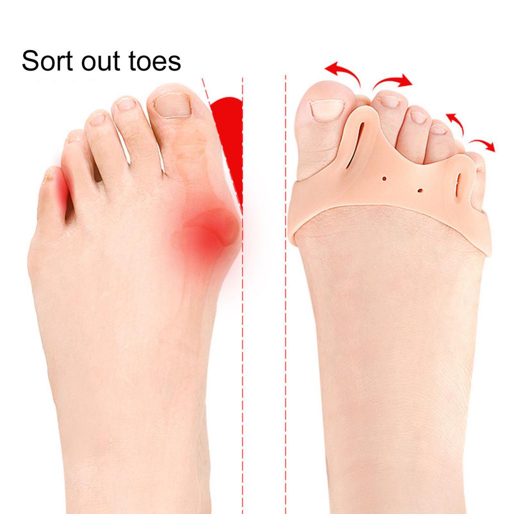1 пара разделителей пальцев ног для женщин, корректор косточек на пальцах ног, мягкие силиконовые разделители для пальцев ног, для устранения накладывающихся друг на друга косточек на мозолях, облегчение боли в передней части стопы