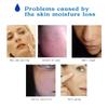Сыворотка для лица с гиалуроновой кислотой ARTISCARE 3 шт./лот HA Essence, увлажняющая, отбеливающая, против морщин, 10 мл