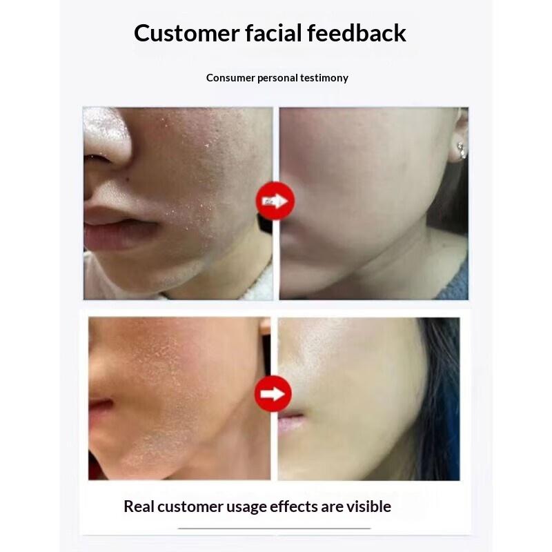 Крем для здоровья Zhuge Taiyi Keikang, красные прыщи на внутренней стороне бедер, паховая эпидермофития, зуд мошонки, грибковая инфекция