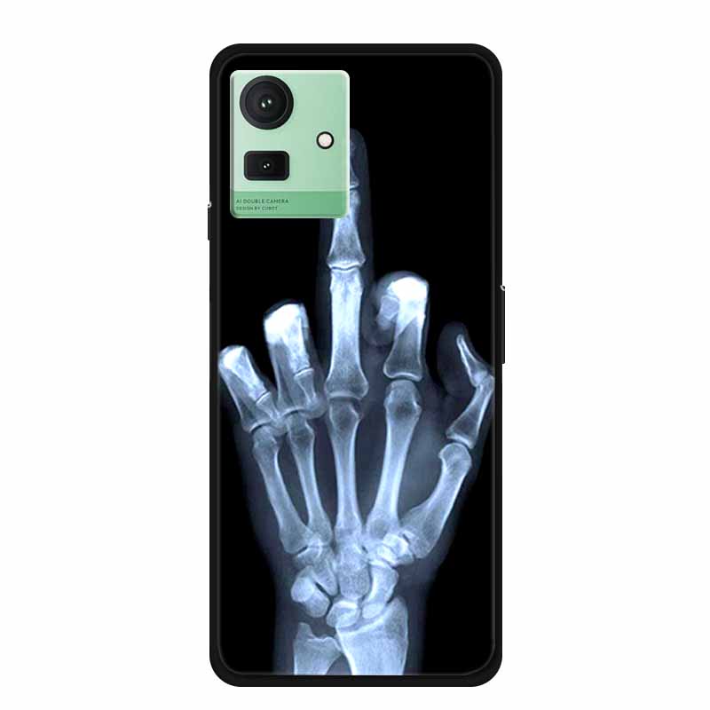 For Cubot Note 50 Case Shockproof Soft Silicone TPU Bumper for CUBOT Note 50 Global Cover Cat Luxury Note50 Cute Cartoon Shell