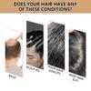 Hair Loss Treatment Shampoo Promotes Growth, Strengthens Roots, Repairs Scalp, Anti-Thinning