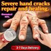 Тайский крем от трещин для ног и рук (Обновлено) 55г Увлажняющий восстанавливающий крем для сухой потрескавшейся кожи, восстанавливающий от обветривания, уход за руками, уход за ногами