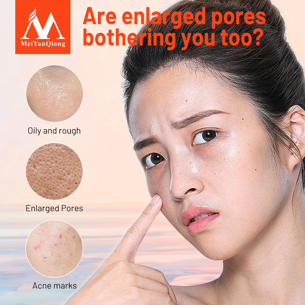 Отбеливающая эссенция для сужения пор с экстрактом гамемелиса 10мл