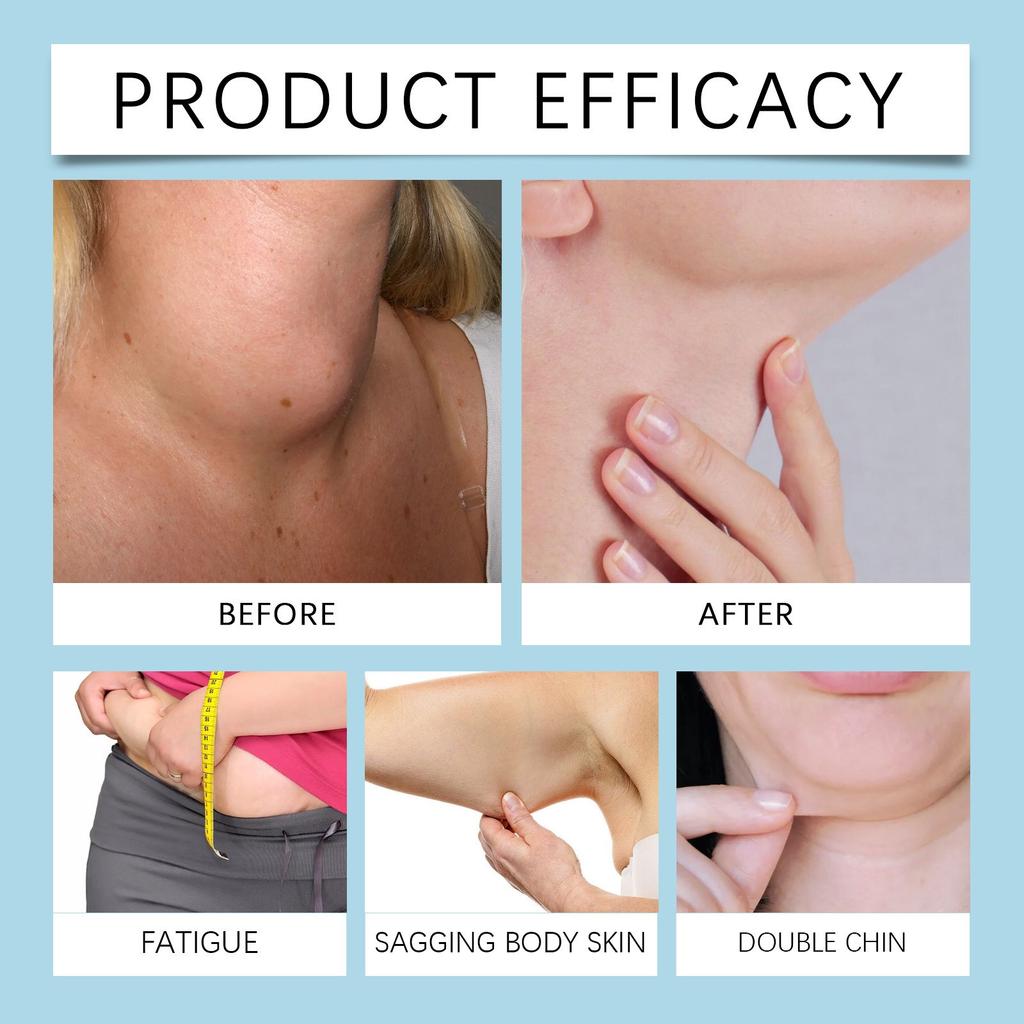 Thyroid Patch Gland Lymph Drainage Effective Heating Neck Sticker Herbal Health Care