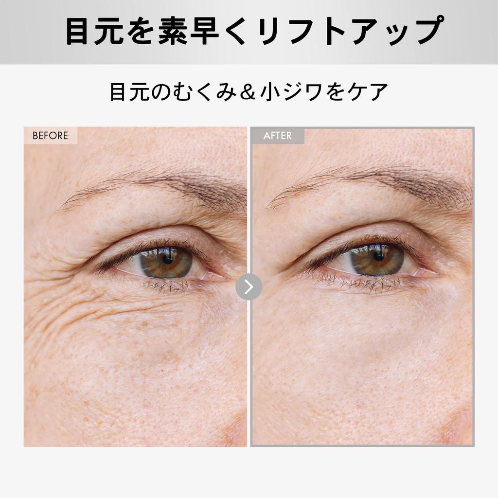 NATUREKIND Hyaluronic Lifting Eye Cream Hyaluronic Fine Korean Skincare 15ml, Acid, Arbutin, Collagen, Crow's Feet, Lines, NatureKind,