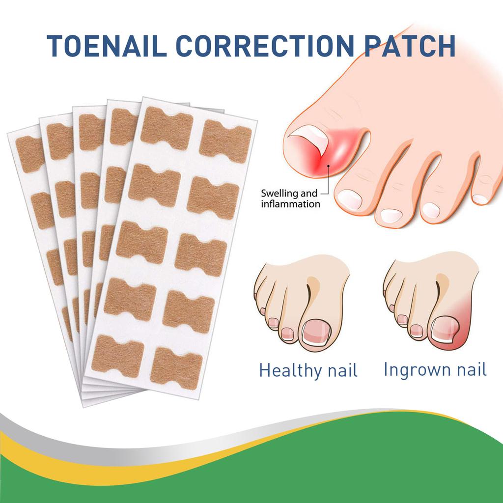 50pcs/Box Ingrown Toenail Sticker Toenail Correction Patch Tools Kit Nail Treatment Foot