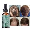 Anti Alopecia Oil Growth Hair Loss Care Product Male Hair Growth Essence Thickener
