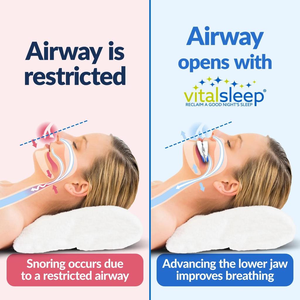 Adjustable Anti Snoring Mouth Guard Braces Sleeping Anti-Snoring Devices Bruxism Snoring Stopper Improve Sleep Snore Mouthpiece