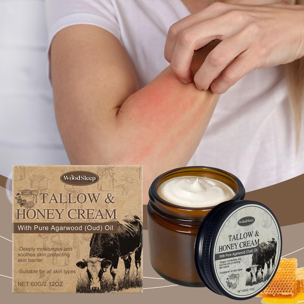 Woodsleep Moisturizing Body Cream With Beef Tallow For Deep Hydration And Skin Relief