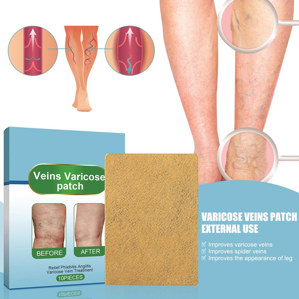 Пластырь для здоровья вен, снимает боль в ногах и отек при варикозном расширении кровеносных сосудов. Пластырь для здоровья вен ног от земляных червей