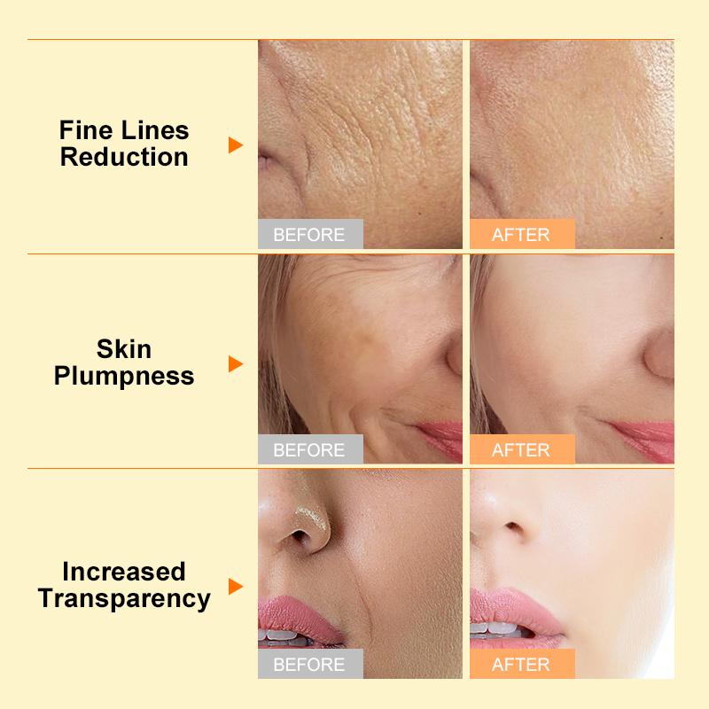 Крем для лица для удаления морщин, антивозрастной коллагеновый крем с гиалуроновой кислотой, увлажняющий лифтинговый крем для лица, средства по уходу за кожей