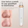 Non Damaging Pores Blackhead Remover Adjustable Power Beauty Device  Personal Care