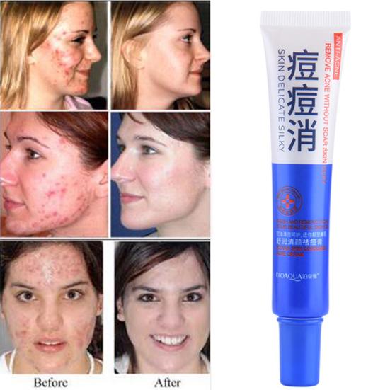 Pimples Removal Shrink Pore Moisturizing Skin Care Cream