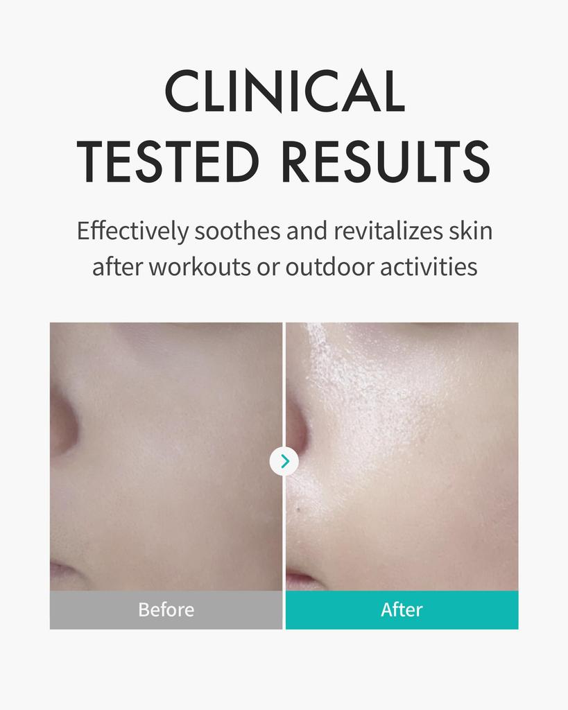 REJURAN Skin Protection Mask X 5 Skin Paria Support Moisturizing Sensitive Skin Sheet Mask Pack Rejuran [Official] (27ml Sheets) c-PDRN