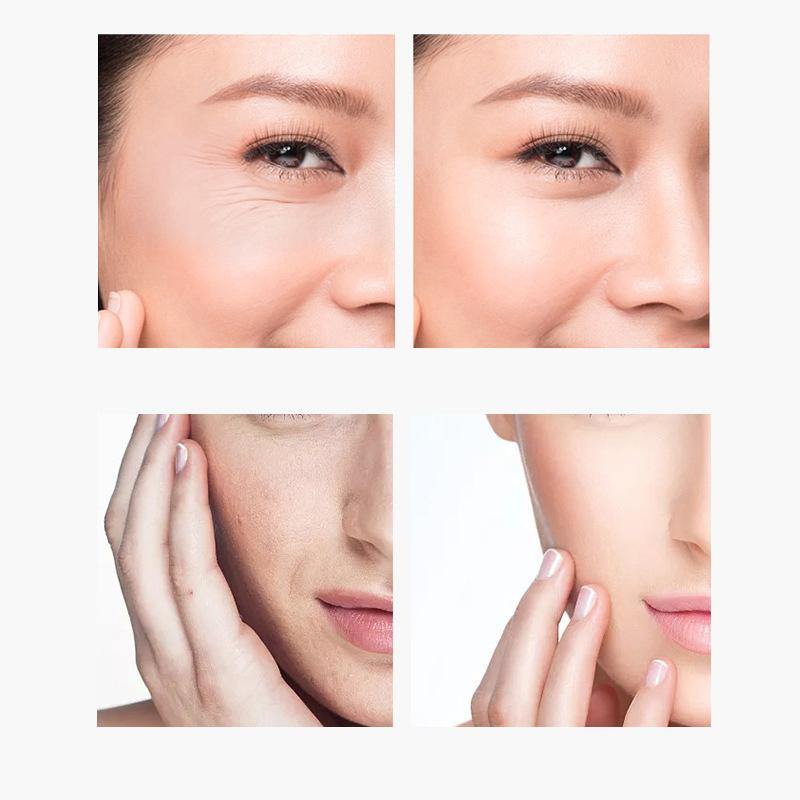 5 пакетов/коробка патч-маска для глаз носогубный пластырь от морщин на лбу против морщин