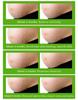 Best Organic Repair Scar Cream Natural Cellulite Removal Anti Pregnancy Stretch Marks Cream For Female