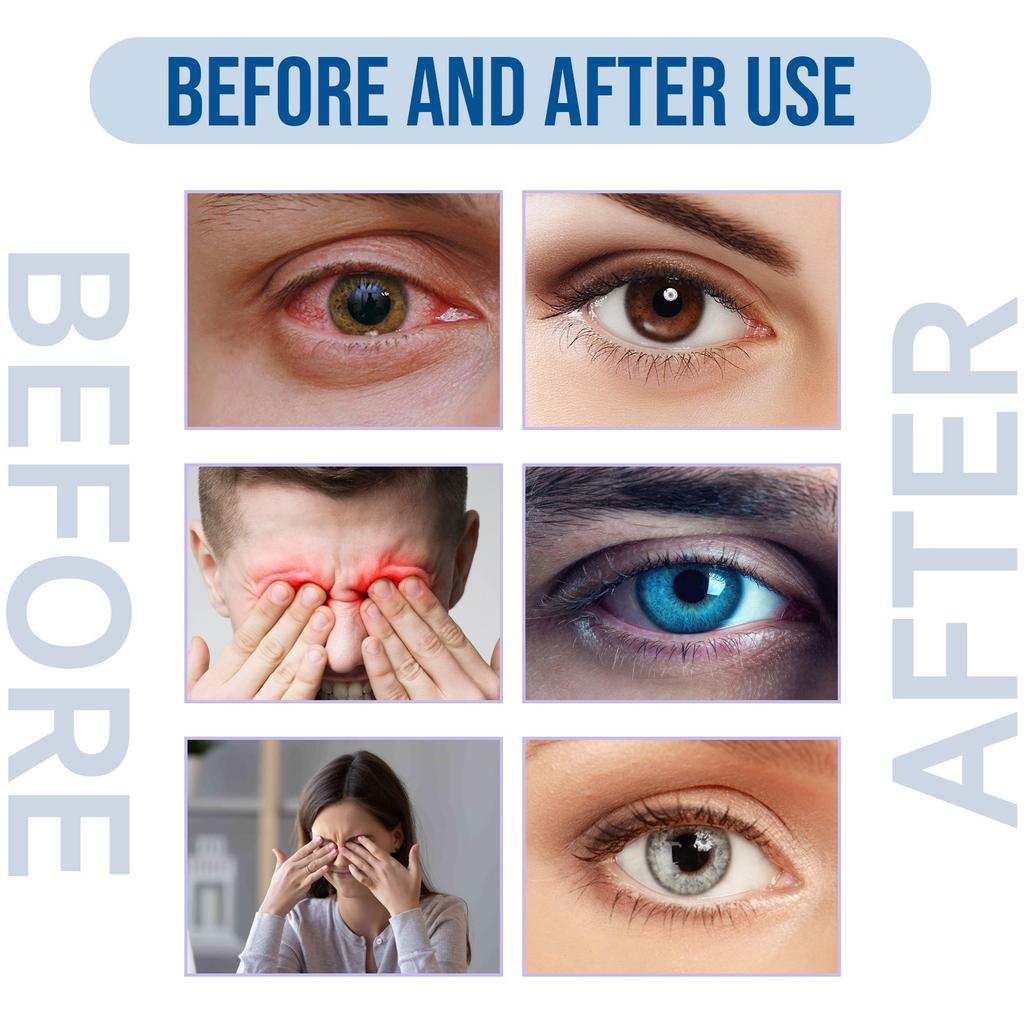 Eye Care Eye Drops Lutein Eye Care, Eye Drops, Eye Drops, Eye Fatigue Relief Eye Moisturizing Care Solution,15ML