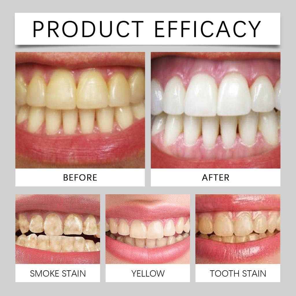 Восстановление зубов Порошок Здоровье Отбеливание зубов Свежее дыхание Уход за полостью рта