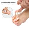 Silicone Adjustable I-Shaped Toe Separator for Overlapping Toe Correction