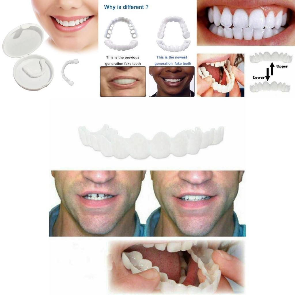 On Fake Snap Teeth Upper Lower Dental Veneers Denture Tooth Cover Simulation Set Cosmetic Braces