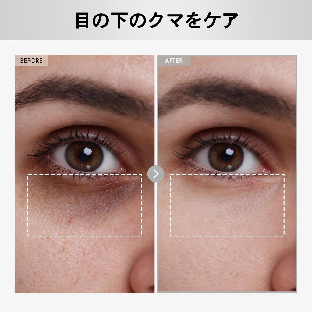 NATUREKIND Hyaluronic Lifting Eye Cream Hyaluronic Fine Korean Skincare 15ml, Acid, Arbutin, Collagen, Crow's Feet, Lines, NatureKind,