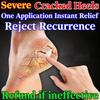 Cracked Foot Cream, Cracked Heel Cream, Cracked Hands and Feet, Fungal Infection, Molting and Cracking Ointment [Buy More for More Discounts]