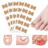 Nail Correction Stickers Corrector Patches Non-Glue Ingrown Toenail Correction Patch Pedicure Tools Foot Care Repairing