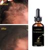 Сыворотка для роста волос предотвращает выпадение волос, способствует росту волос, повышает их жизненную силу, утолщает волосы, увлажняет и питает волосы.