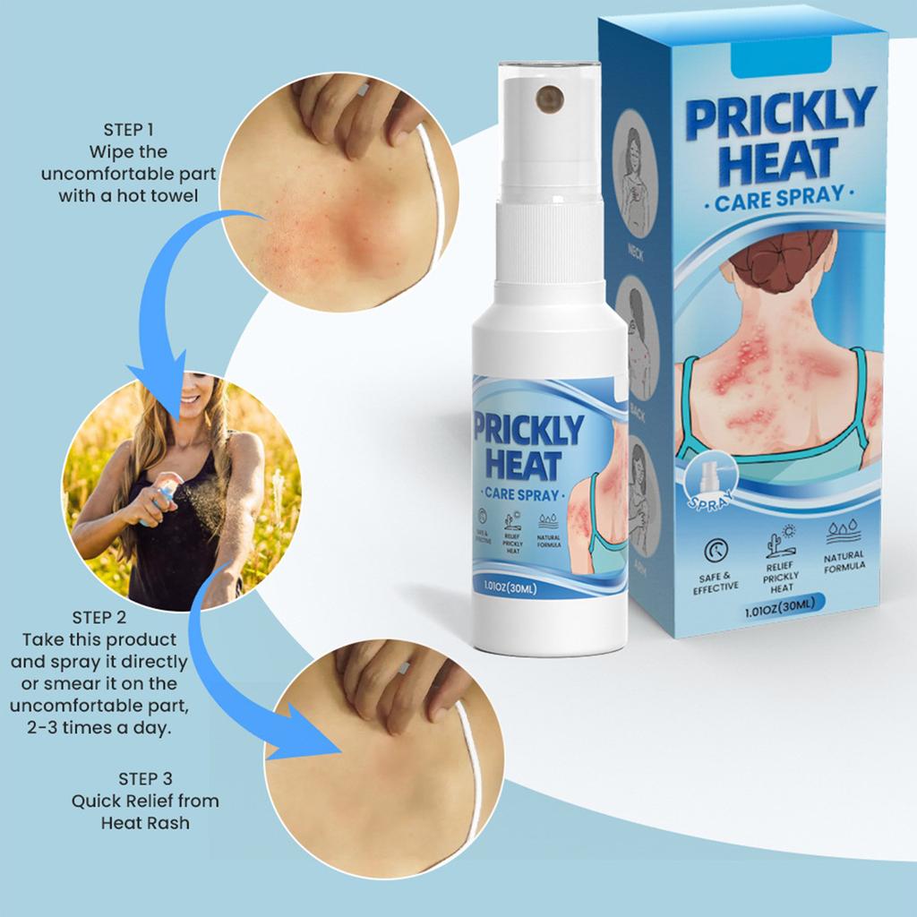 Heat Rash Spray, Quick Relief Of Itching 30ml
