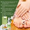 Nail Repairing Lotion Repairing Nails Care Hand Foot And Nails Nourishing Soft Nail Care 30ml