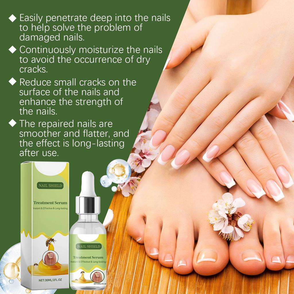 Nail Repairing Lotion Repairing Nails Care Hand Foot And Nails Nourishing Soft Nail Care 30ml