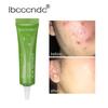 Herbal Essence Acne Cream Effective Acne Removal Scar Deposition Pigment Plant Essence Acne Cream
