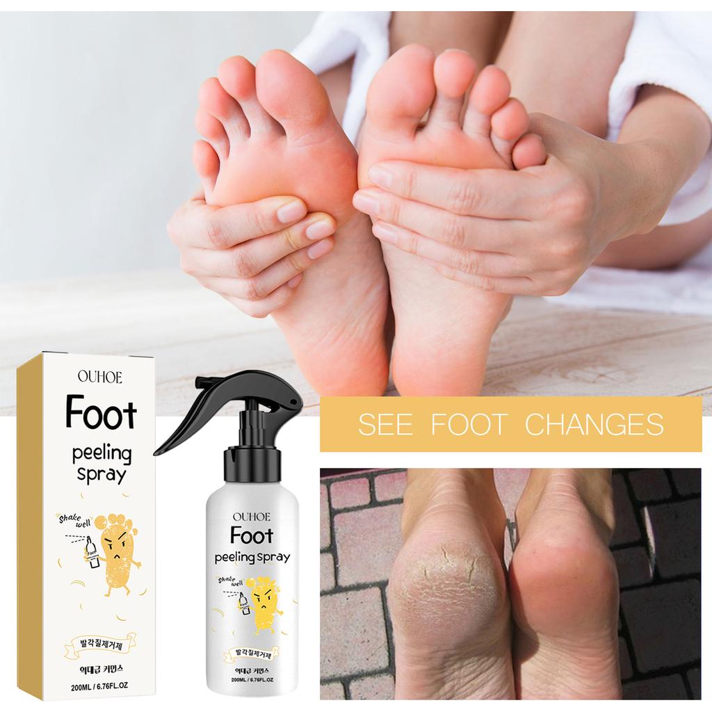 EELHOE Foot Peeling Spray Natural Orange Essence Pedicure Hands Dead Skin Exfoliator Mask Whiten Baby Foot Care Tool
