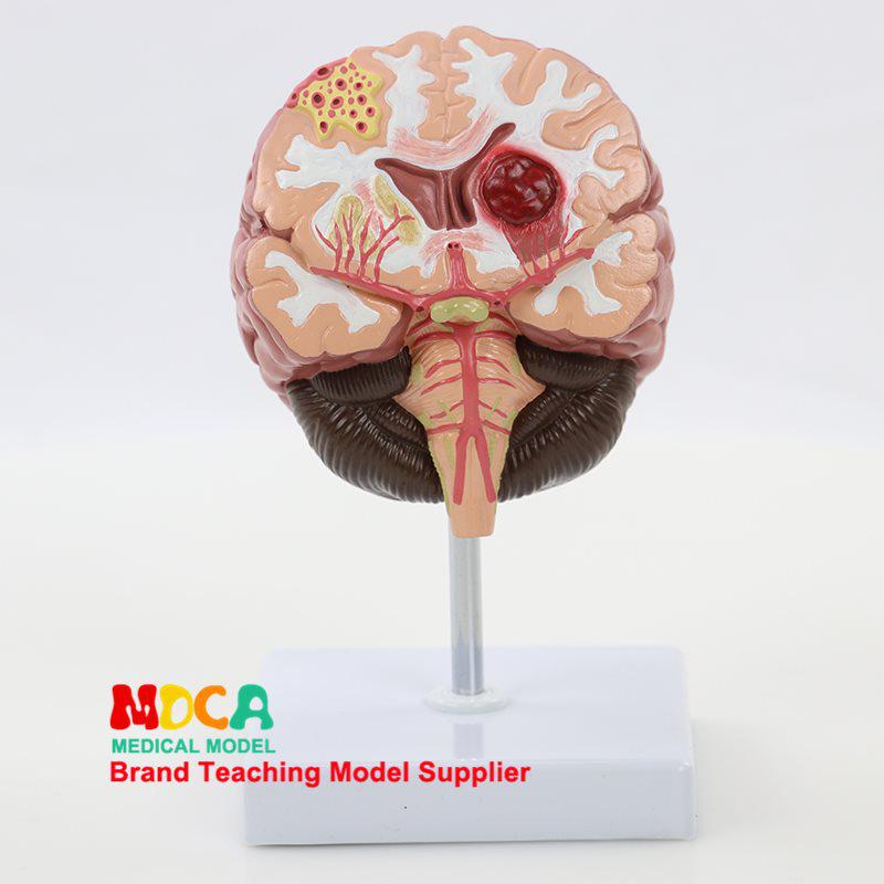 1:1 Scale Right Hemisphere Brain Model - Neocortical Structure & Functional Areas for Medical Education