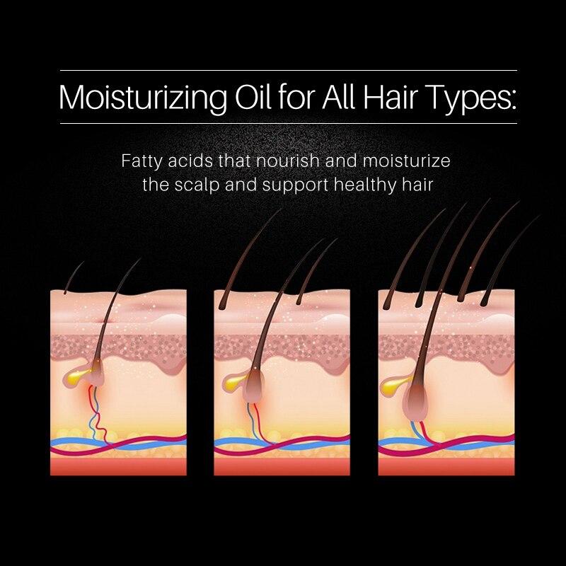 50ml Black Rice Water Hair Spray Hair Growth Essence Anti Hair Loss Natural Thinning Anti Hair Loss Soothe Itchy Dry Scalp Care