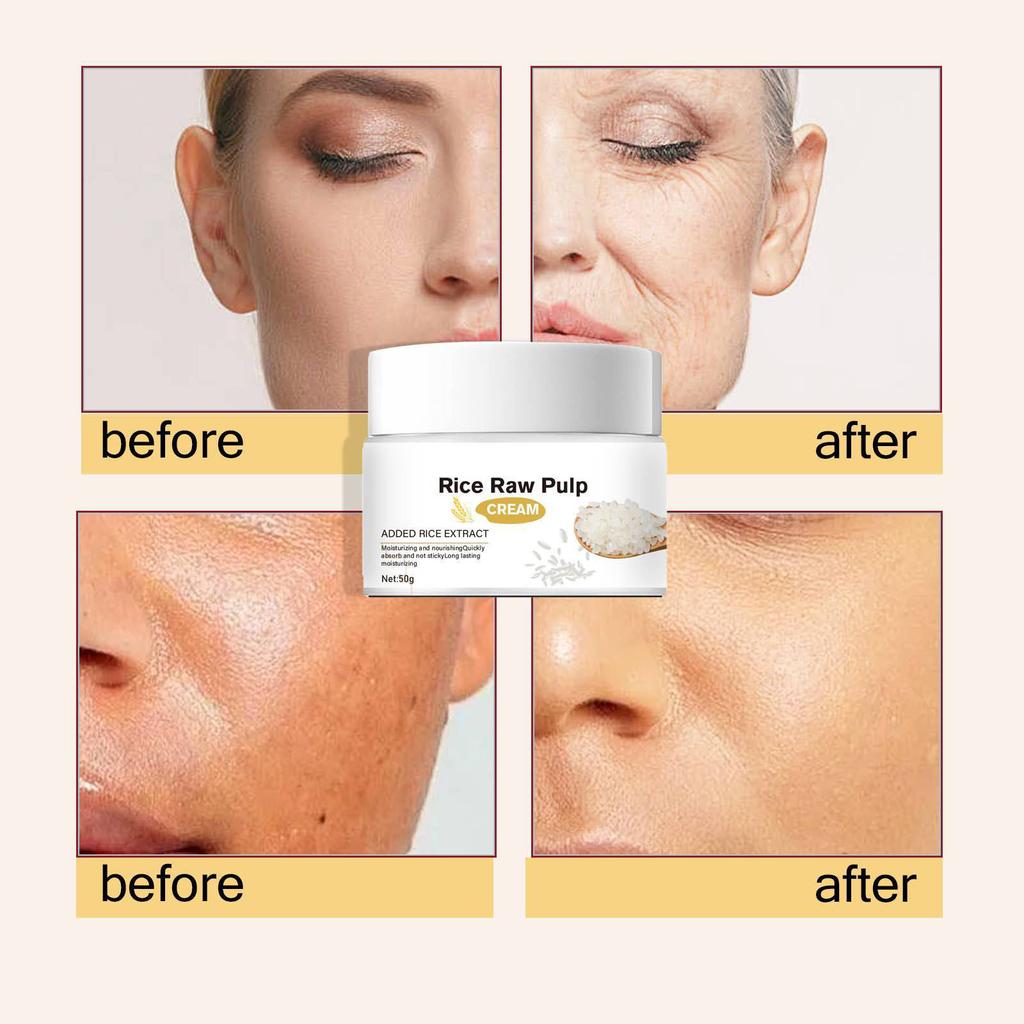 Anti-Freckle Brightening Hydrating Moisturizing Moisturizing Rejuvenating Skin Brightening