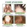 2pcs Hair Regrowth Serum | Natural Hair Growth Treatment | Essential Oil Repair Care