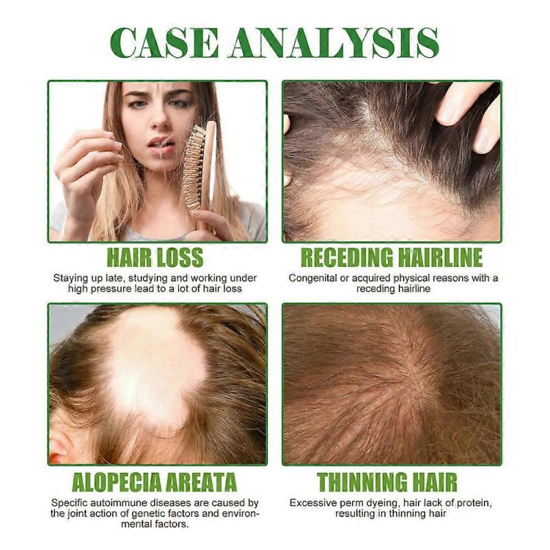 2pcs Hair Regrowth Serum | Natural Hair Growth Treatment | Essential Oil Repair Care