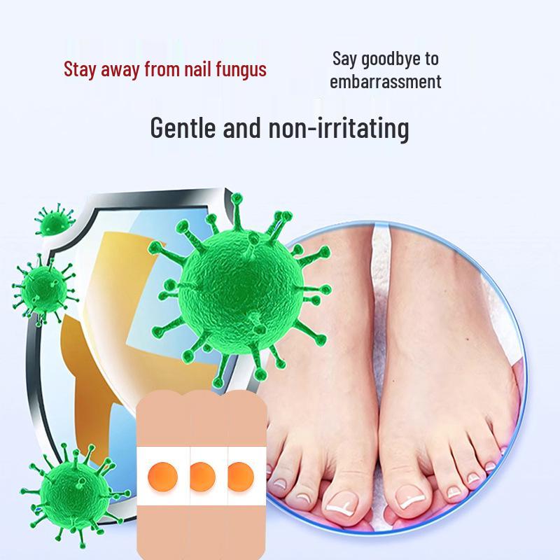 Guo Yi Onychomycosis Patch: Nail & Toe Care for Gray Nails