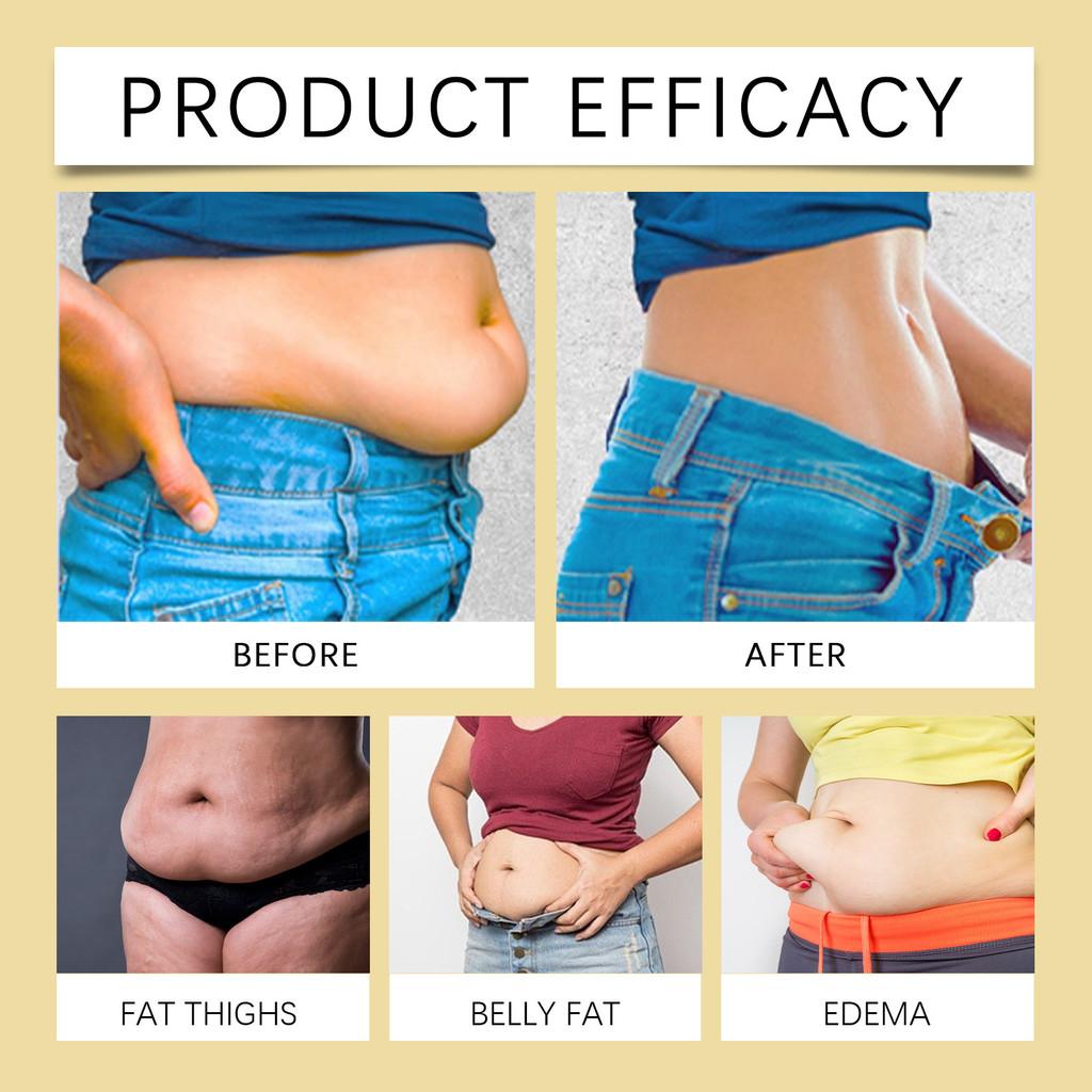 Пластыри для лимфодренажного моделирования тела Ximonth с пчелиным ядом для упругой подтянутой кожи и более стройной фигуры