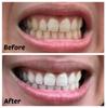 105g Toothpaste Teeth Whitening Refresh Breath Stain Remove White Teeth Cleaning Hygiene Oral Care Dental Toothpaste Clean Teeth Ordor Remover