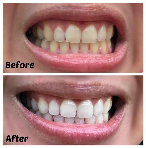 105g Toothpaste Teeth Whitening Refresh Breath Stain Remove White Teeth Cleaning Hygiene Oral Care Dental Toothpaste Clean Teeth Ordor Remover