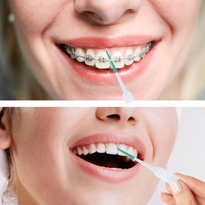 40200 Units Soft Glue Interdental Brush Interdental Brush Interdental Brush Orthodontic Specific Gap Brush Disposable