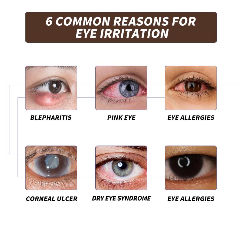 Eye Care Spray Mild Formula Protects Eyes Moisturizing And Comfortable Daily Eye Moisturizing Spray