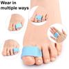 1Pc Overlapping Toe Separator Orthopedic Bunion Valgus Hammertoe Corrector Pain Relief