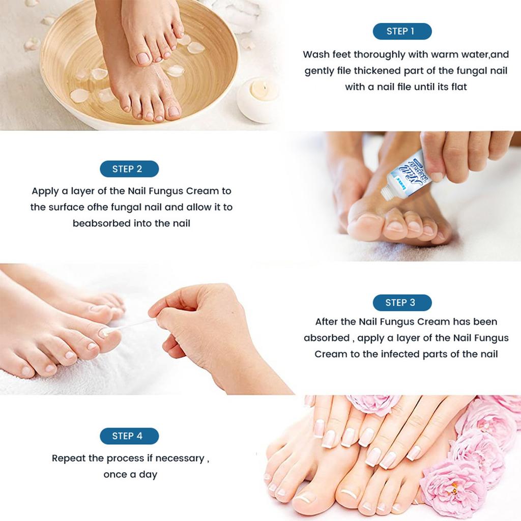 Крем для лечения ногтей, улучшает твердость ногтей, осветляет цвет ногтей