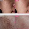 TOSOWOONG Крем с арбутином 7% и транексамовой кислотой 4% 50 мл Осветляющий K-Beauty 50 г