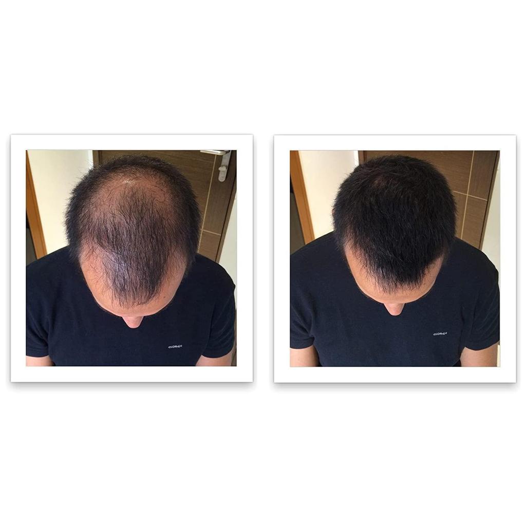 Волокна для наращивания и утолщения волос для естественного вида волос, наполнители, скрывающие выпадение волос, для мгновенного утолщения истончения, черные 25 г