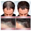 3Pcs Zephta H-Regrow 2.0, Zephta Hair Regrowth, Prorevita Rice Nutri Spray, for Hair