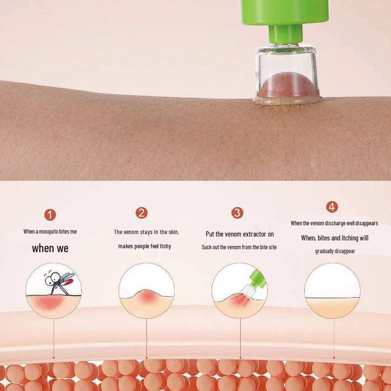 Portable Venom Extractor: First Aid for Insect Bites and Outdoor Relief